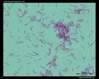 Capnocytophaga microscopy